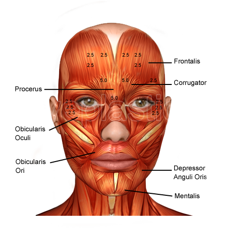 Orbicularis oculi and facial muscles — blepharospasm injection anatomy
